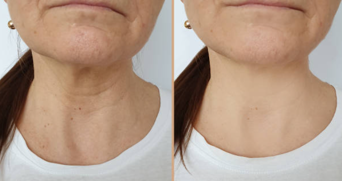 Cutis Prime ® Korean PDRN Cream.