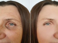 Cutis Prime ® Korean PDRN Cream.