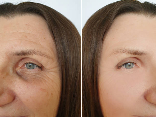 Cutis Prime ® Korean PDRN Cream.