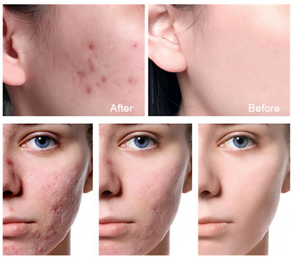 Piel sensible, rojeces, sequedad o sensación de irritación…? Te recomendamos este Skincare Coreano