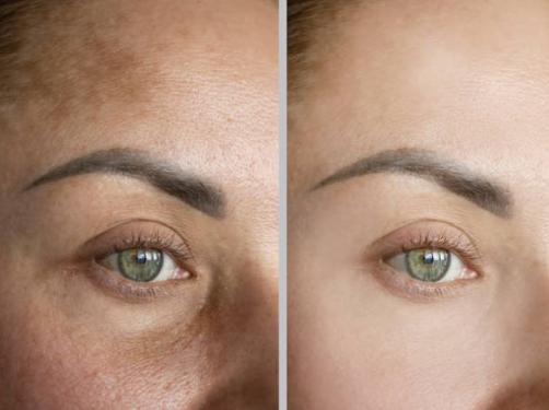Piel sensible, rojeces, sequedad o sensación de irritación…? Te recomendamos este Skincare Coreano