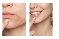 CUTIS PRIME® 345 Dr. Althea Korean Relief Cream.