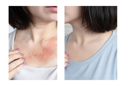Piel sensible, rojeces, sequedad o sensación de irritación…? Te recomendamos este Skincare Coreano